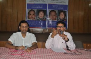 Himalayan Hospital to welcome Smile Torch to Doon